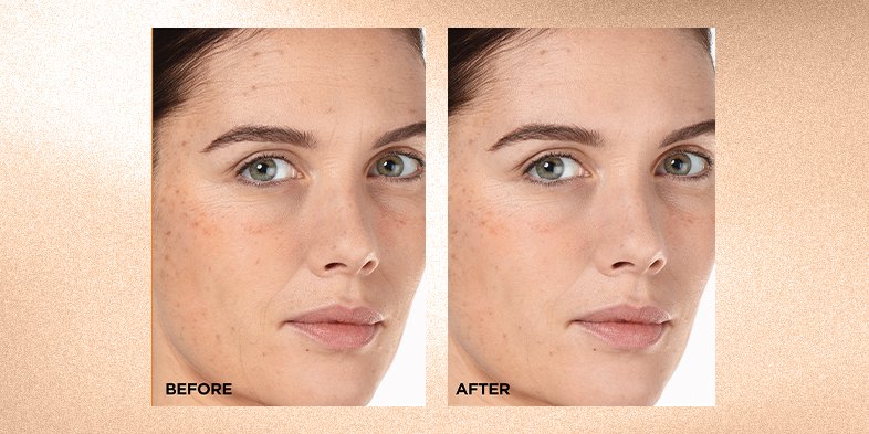 InArticlereasonstouseserumRevitaLift 12 Pure Vitamin C E Salicylic Acid Serum